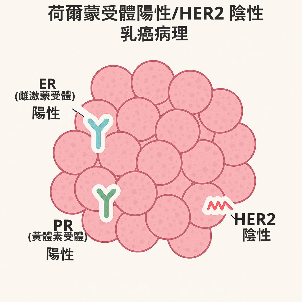 荷爾蒙陽性乳癌